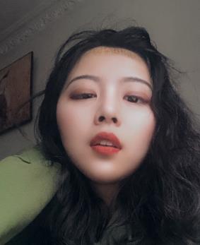 徐州三院植发靠谱吗？三甲医院技术真不赖！