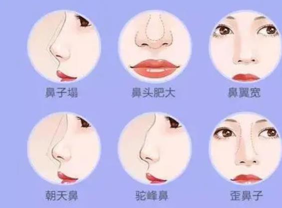 中日友好医院路会医生挂号预约？做鼻子隆鼻咋样？价格收费贵不？