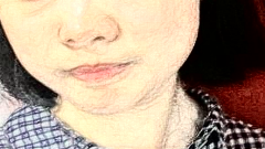 7d聚拉提有修复期吗?修复期多久?