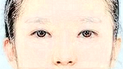 7d聚拉提有修复期吗?修复期多久?