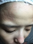 做绣眉整形术后能保持多久成果