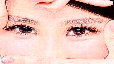 太原双眼皮手术比较好的医生有哪些?太原做双眼皮出名的医生排名推荐及实例