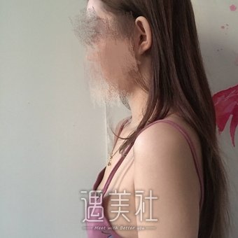 贵州省人民医院可以隆胸吗?多少钱？医生介绍+实例