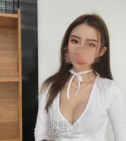 贵州省人民医院可以隆胸吗?多少钱？医生介绍+实例