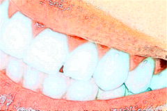 南京金铂利口腔隐适美矫正正规吗？医院简介