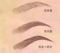 激光洗眉一般需要多少钱？会留疤吗？价格表+激光洗眉一到七天图片