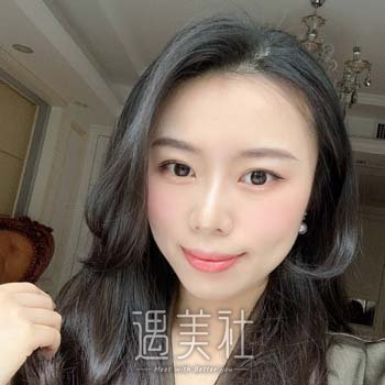 南华大学附属第二医院割双眼皮多少钱？哪位医生好？附实例