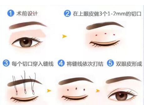 QQ截图20191016131139.jpg 湖州九八医院割双眼皮多少钱?附上医院简介+2022价格表参考!