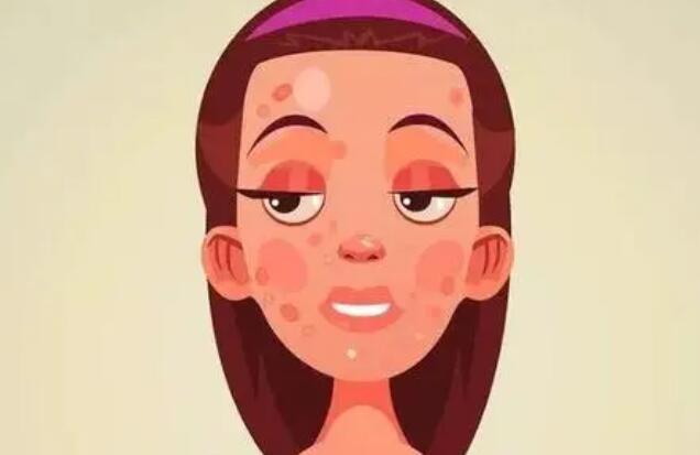 祛痘动漫02.jpg 祛痘动漫02.jpg