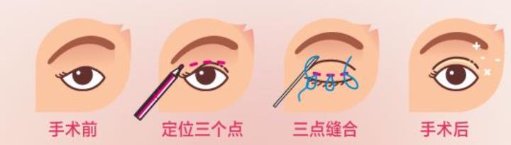 双眼皮动漫h81.jpg 双眼皮动漫h81.jpg