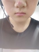 下巴太短，可以用哪些方法来改善呢？(女孩有双下巴，适合做什么类型的项目？)