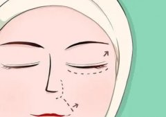 崔慧棣医生怎么样?医生技术点评|坐诊医院|双眼皮实例(动漫成果)