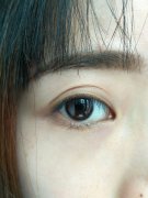 为什么很多外面的医美机构丰胸价格会差这么多(乳房下垂怎么办选择隆胸还是悬吊丰胸假体丰胸悬吊胸女性健康)