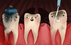 南方医科大学第三附属医院口腔科怎么样？詹雪玲医生介绍+根管治疗实例！