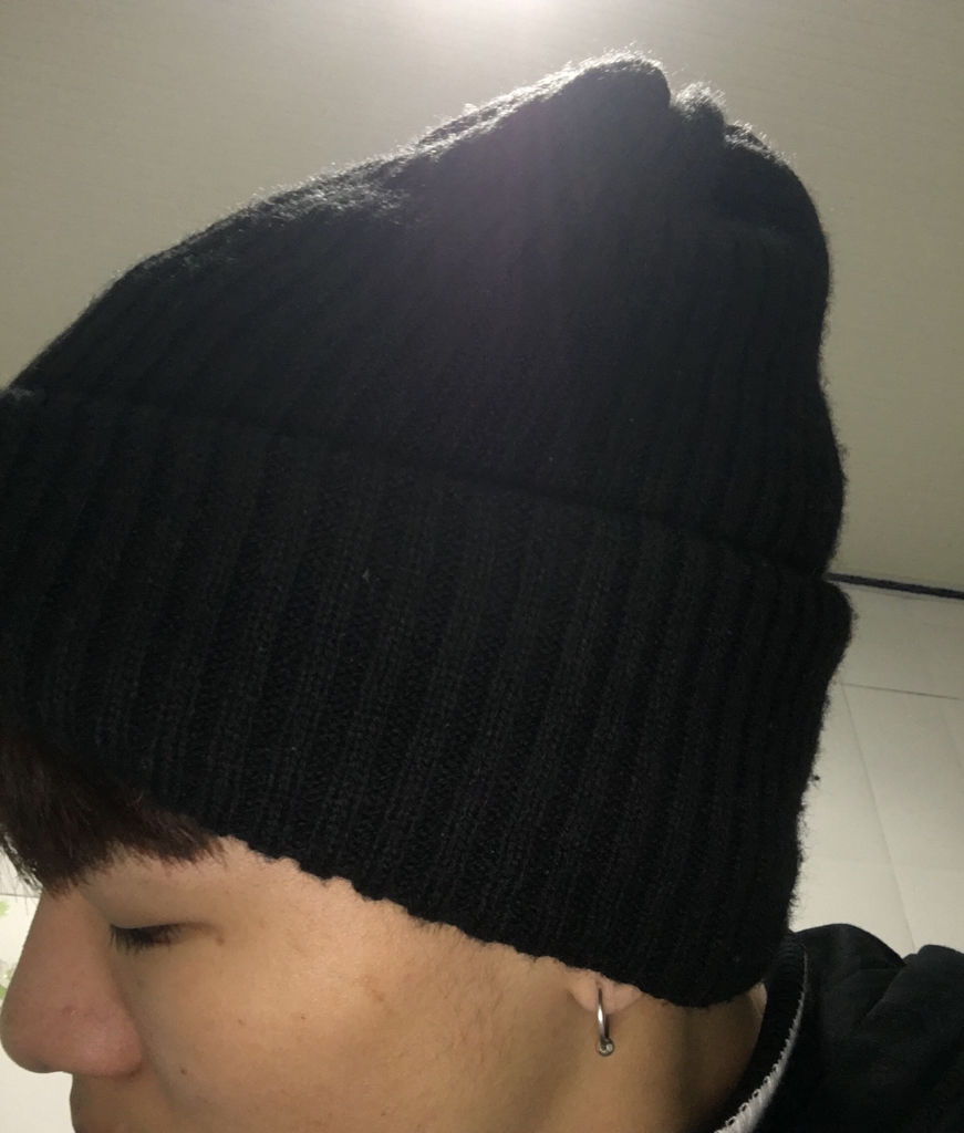 很多粉丝咨询先做近视手术还是双眼皮手术，现在回答一下(小眼症是可以遗传的！！关注小朋友的眼睛功能同时，更要关注小朋友的)