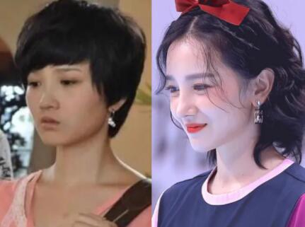 陈小纭整骨怎么整得？她磨骨了吗？粉丝深扒前后对比图