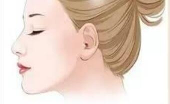 l下颌角q.jpg l下颌角q.jpg