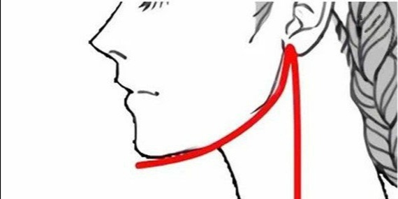 下颌角手术4.jpg 下颌角手术4.jpg