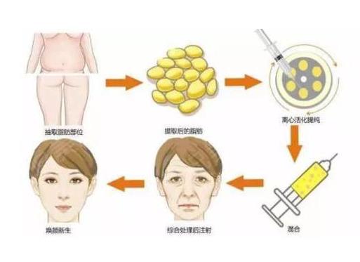 填充.jpg 填充.jpg