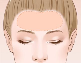 u=3741191645,3565661394&fm=26&gp=0.jpg 杭州鹏爱医疗美容医院好吗?刘富华医生技术点评+下颌角实例+价格表一览