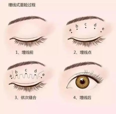 2022温州医科大学附属第一医院整形科价格表公布，【李力群】医生资料看这篇！