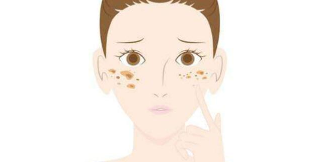 l祛斑r01.jpg l祛斑r01.jpg