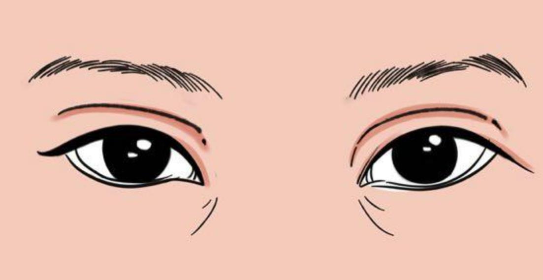 双眼皮动漫1.jpg 双眼皮动漫1.jpg