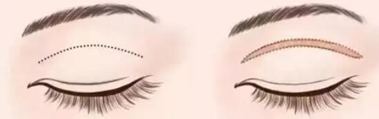 双眼皮动漫20.jpg 双眼皮动漫20.jpg