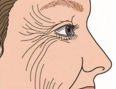 韩国美丽世界整形外科咋样?李正秀医生简介+玻尿酸填充实例+价格表