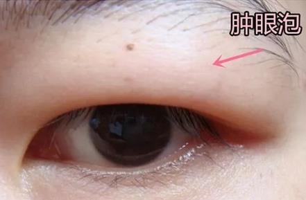 深圳富华医疗美容医院价格表太nies了！金顺女医生服务很可！