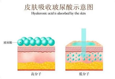 深圳鹏爱医疗美容医院价格真实惠！周鹏武医生被众人推荐！