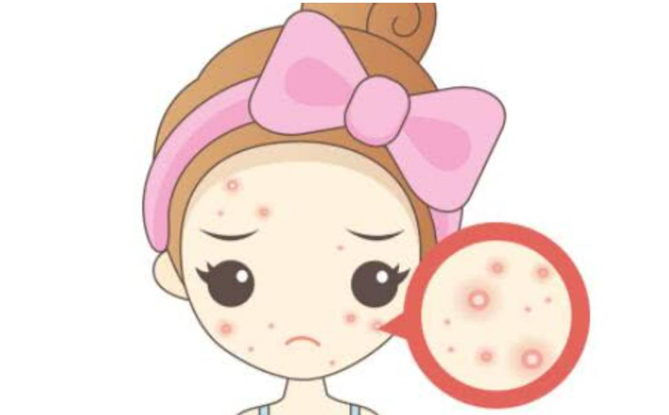 祛痘动漫1.jpg 祛痘动漫1.jpg