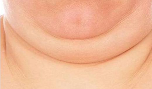 安徽医科大学第一附属医院整形科价目表！赵宇er张林！口碑全新查询