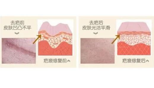 北京安贞医院整形科双眼皮价目表！李斌斌、杨媚口碑风格查询