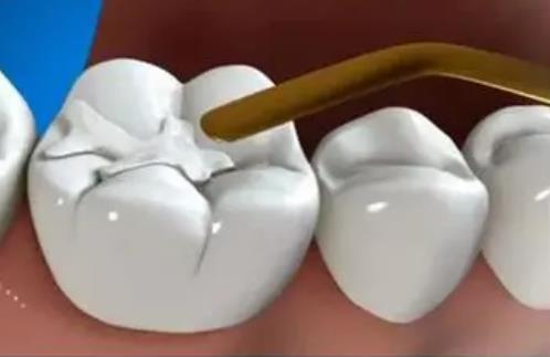 北京市东城区口腔医院整形科怎么样？参考价格收费标准了解实力！