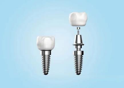 微信截图_20220426173602.jpg 北京口腔医院种植牙价格表!陈仁吉徐雪骨干医生技术真的没话说