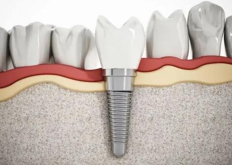 微信截图_20220426173856.jpg 中国医科大学附属口腔医院正畸价格表汇总!张扬、侯志明成果深受好评