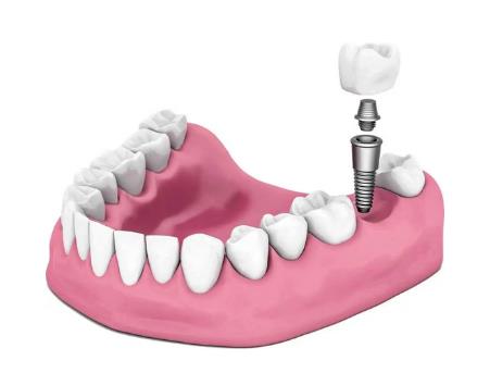 微信截图_20220426174556.jpg 重庆医科大学附属口腔医院价格表!张碧、王茜等多位骨干医生很是受认可