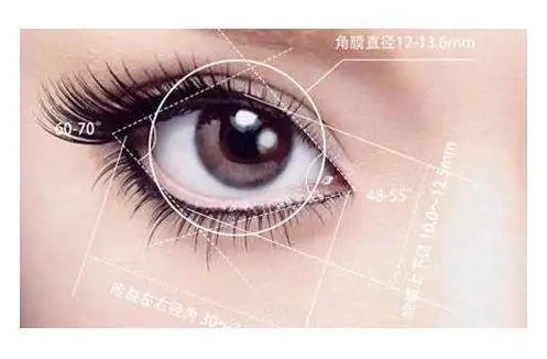 开眼角一般需要多少钱？