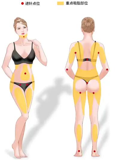 QQ截图20220414153423.jpg 台州吸脂医院哪家好?排行榜大爆料!内附非常新价格表分享!