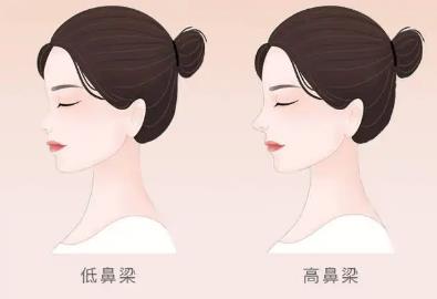 吴昌炎隆鼻手术技术如何？医生综合实力介绍+隆鼻实例