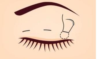 双眼皮动漫25.jpg 双眼皮动漫25.jpg