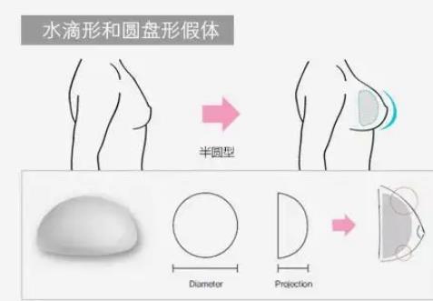 复旦大学附属华山医院整形科价格表查收！热门隆胸骨干医生【江华】口碑分析