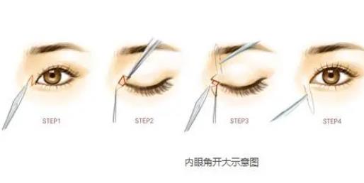 河北医科大学第三医院整形科价格表2022版！含双眼皮骨干医生曹莫、张川口碑推荐！