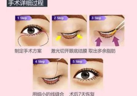 微信截图_20220506171028.jpg 上海交通大学医学院附属仁济医院整形科价格表!含范志宏资料及干货科普!