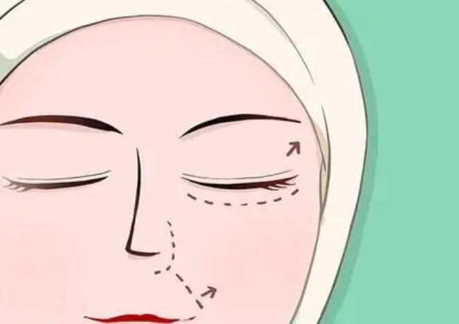 山东省立医院双眼皮修复怎么样医生简介价格参考案例反馈