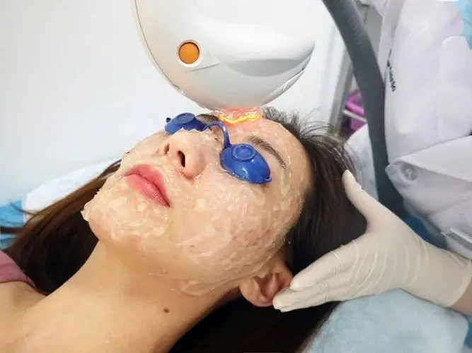 光子嫩肤能反黑的原因是什么?反黑了怎么办