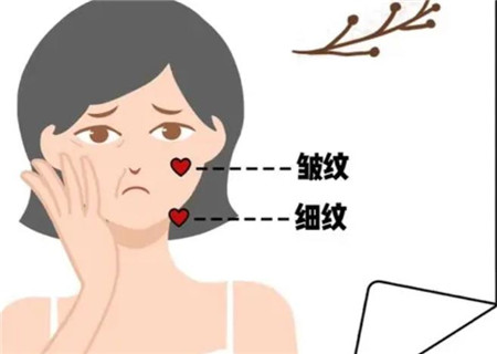 筋膜悬吊除皱手术有哪些优势