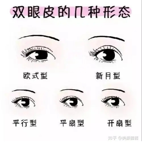 韩式双眼皮or欧式双眼皮，哪个更好看?