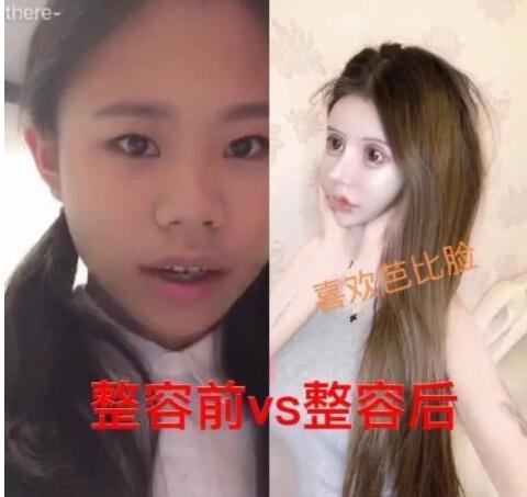 15岁女孩整容60次是真实的吗？她做了哪些部位？现在的她怎么样了？